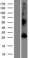PHETA2 Human Over-expression Lysates NM_001002034