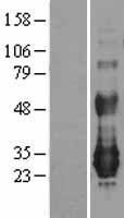 NFAM1 Human Over-expression Lysates NM_145912