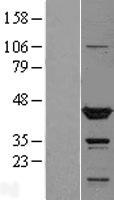 TTL Human Over-expression Lysates NM_153712