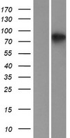 CKAP2L Human Over-expression Lysates NM_152515