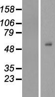 TEKT4 Human Over-expression Lysates NM_144705