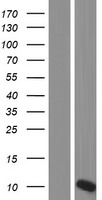 OTOS Human Over-expression Lysates NM_148961