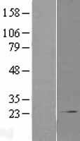 COMMD1 Human Over-expression Lysates NM_152516