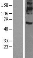 Prominin 2 (PROM2) Human Over-expression Lysates NM_144707