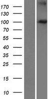 FBXO41 Human Over-expression Lysates NM_001080410