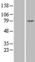 TTC30B Human Over-expression Lysates NM_152517