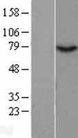 GPAT 2 (GPAT2) Human Over-expression Lysates NM_207328