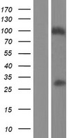 FAM59B (GAREM2) Human Over-expression Lysates NM_001168241