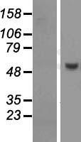 PUS10 Human Over-expression Lysates NM_144709