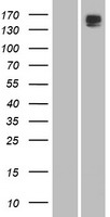 Phospholipase A2 (PLB1) Human Over-expression Lysates NM_153021