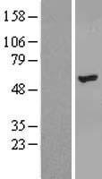 ls151126 znf385b human over expression lysates nm 152520 wb testing 1