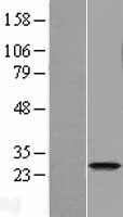 FAM119A (METTL21A) Human Over-expression Lysates NM_145280