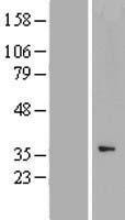 ls151195 ccnyl1 human over expression lysates nm 152523 wb testing 1
