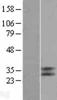 GPBAR1 Human Over-expression Lysates NM_001077191