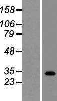 GPBAR1 Human Over-expression Lysates NM_170699
