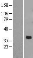 ls151313 fahd2b human over expression lysates nm 199336 wb testing 1
