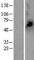 Monocarboxylate transporter 14 (SLC16A14) Human Over-expression Lysates NM_152527