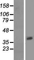 ASPRV1 Human Over-expression Lysates NM_152792