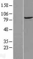 DTX3L Human Over-expression Lysates NM_138287