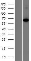 Shugoshin (SGO1) Human Over-expression Lysates NM_001012410