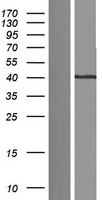 Shugoshin (SGO1) Human Over-expression Lysates NM_001012411