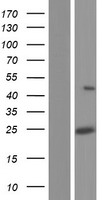 LRRC34 Human Over-expression Lysates NM_001172779