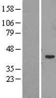 LRRC34 Human Over-expression Lysates NM_153353