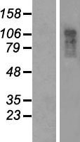CCDC80 Human Over-expression Lysates NM_199512