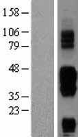 CD272 (BTLA) Human Over-expression Lysates NM_181780