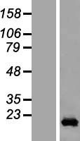 CCDC12 Human Over-expression Lysates NM_144716