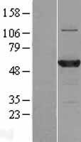 C3orf59 (MB21D2) Human Over-expression Lysates NM_178496