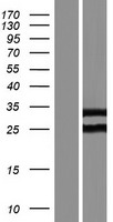 ROPN1B Human Over-expression Lysates NM_001012337