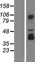 CCDC52 (SPICE1) Human Over-expression Lysates NM_144718