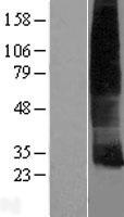 Cklfsf8 (CMTM8) Human Over-expression Lysates NM_178868