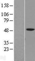 IGSF11 Human Over-expression Lysates NM_152538