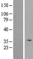 ls152816 odaph human over expression lysates nm 178497 wb testing 1