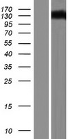 DAB2IP Human Over-expression Lysates NM_032552