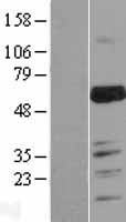 MARVELD2 Human Over-expression Lysates NM_001038603