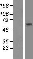 ls153642 arsk human over expression lysates nm 198150 wb testing 1