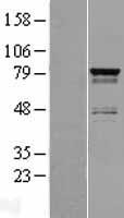 RNF158 (SH3RF2) Human Over-expression Lysates NM_152550