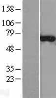 CNKSR3 Human Over-expression Lysates NM_173515