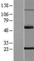 ls154197 pnldc1 human over expression lysates nm 173516 wb testing 1
