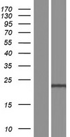 NKAIN2 Human Over-expression Lysates NM_153355