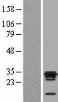 Ecat1 (KHDC3L) Human Over-expression Lysates NM_001017361