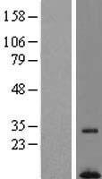 C7orf55 (FMC1) Human Over-expression Lysates NM_197964
