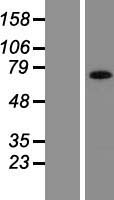 Angiomotin (AMOT) Human Over-expression Lysates NM_133265