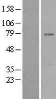GIMAP8 Human Over-expression Lysates NM_175571