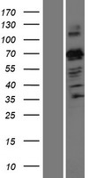 PARIS (ZNF746) Human Over-expression Lysates NM_001163474