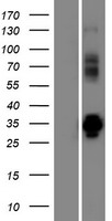 VPS37D Human Over-expression Lysates NM_001077621