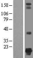 NSUN5P1 Human Over-expression Lysates NM_001039575